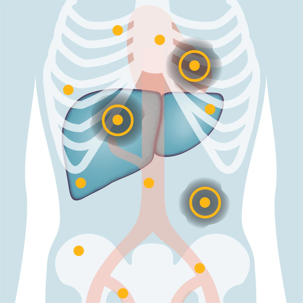 oncology-human-organs-scientific-illustration