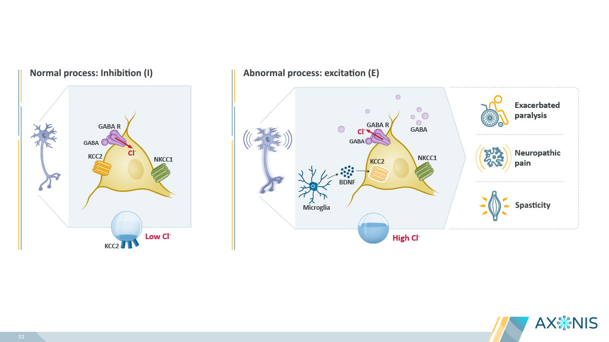 This slide illustrates the difference between normal inhibitory processes in neurons and abnormal excitatory processes that can occur after Spinal Cord Injury (SCI). It depicts the role of GABA receptors, chloride ions (Cl-), and transporters like KCC2 and NKCC1 in these processes, linking abnormal excitation to conditions like exacerbated paralysis, neuropathic pain, and spasticity.